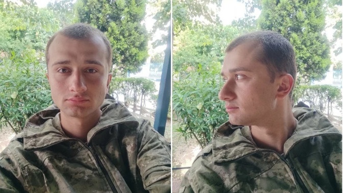 Burun estetiği yaptırmalı mıyım sizce?