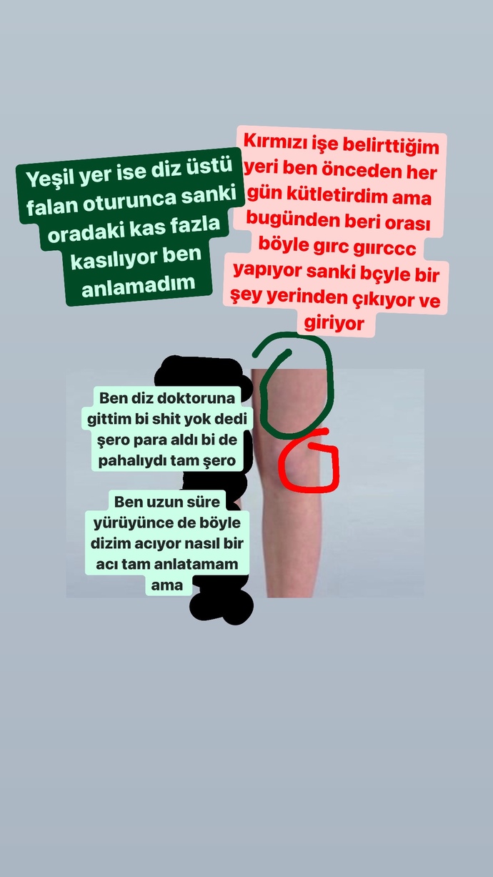 Arkadaşlar dizimin nesi var?