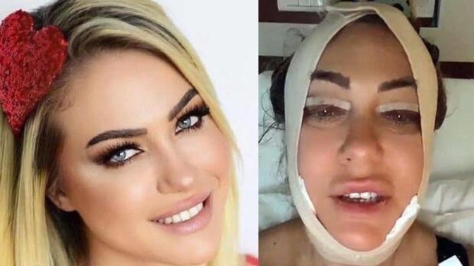 Güzellik için estetik yaptırır mısınız?