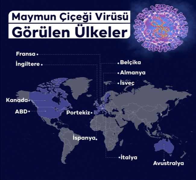 Türkiye'de ilk maymun çiçeği vakası görüldü! Kısıtlama olur mu?
