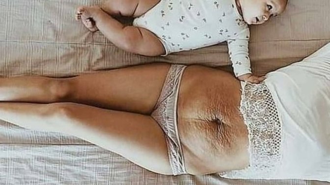 Doğum yapmış eşiniz, ya da  doğum yapmış sevgilinizin göbeğinde çatlaklar varsa seks yaparken bu sizi rahatsız eder mi?