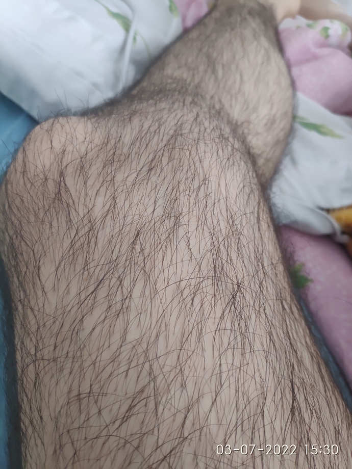 Bacağım çok mu kıllı?