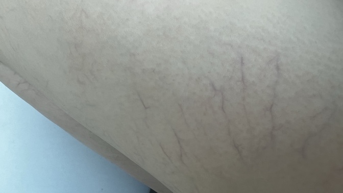 Merhaba, bunları hangi doktor tedavi eder?