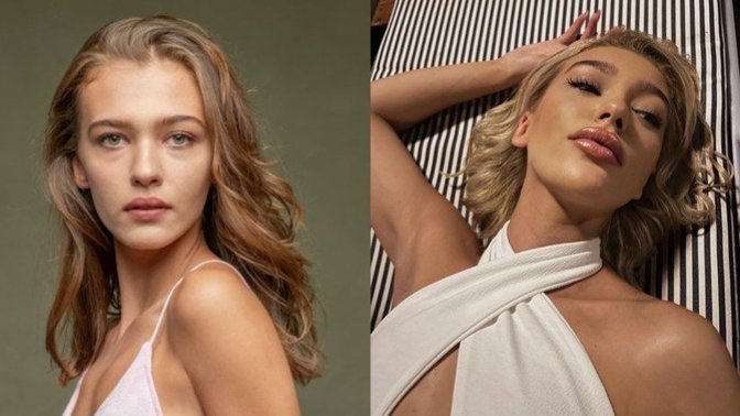 Melisa Döngel'in eski ve yeni hali gündem oldu! Sizce Melisa'nın yaptırdığı işlemler nasıl olmuş?