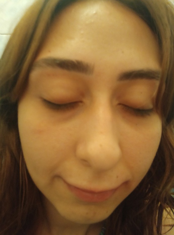 Yüz şeklimde olan tuhaflık?