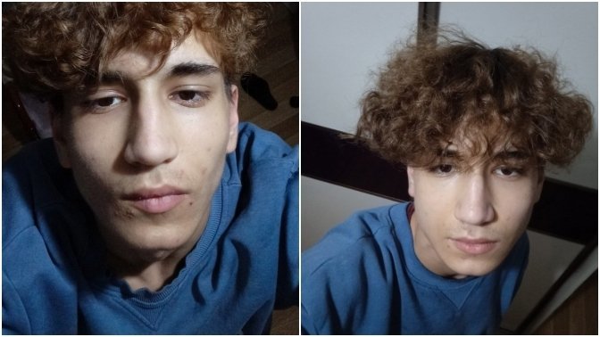 2 haftada 10 kilo verdim yüzüm çöktü, kilo alınca yüzüm düzelir mi?