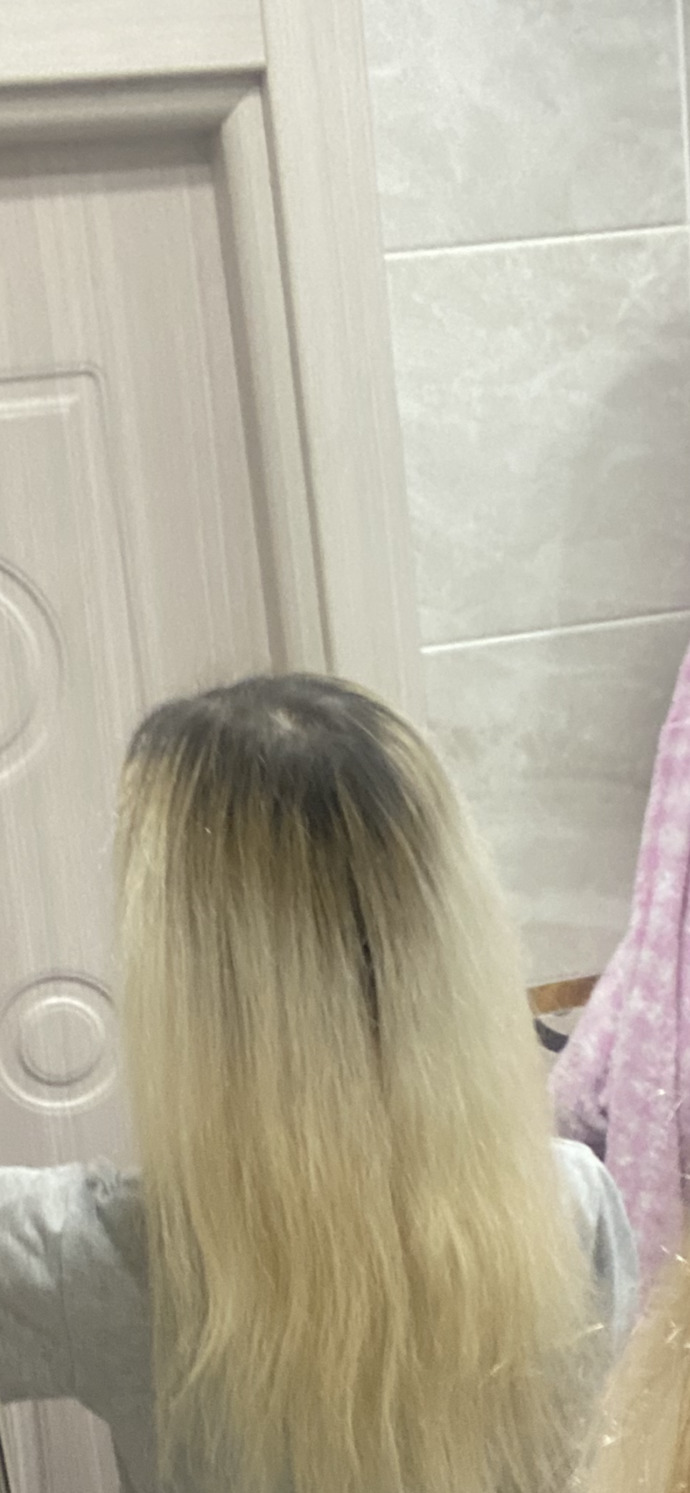 Dip boyam çok mu aşağı inmiş, boyasam da düzelmeyecek mi?