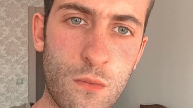 Sizce çok mu zayıf yüzüm?