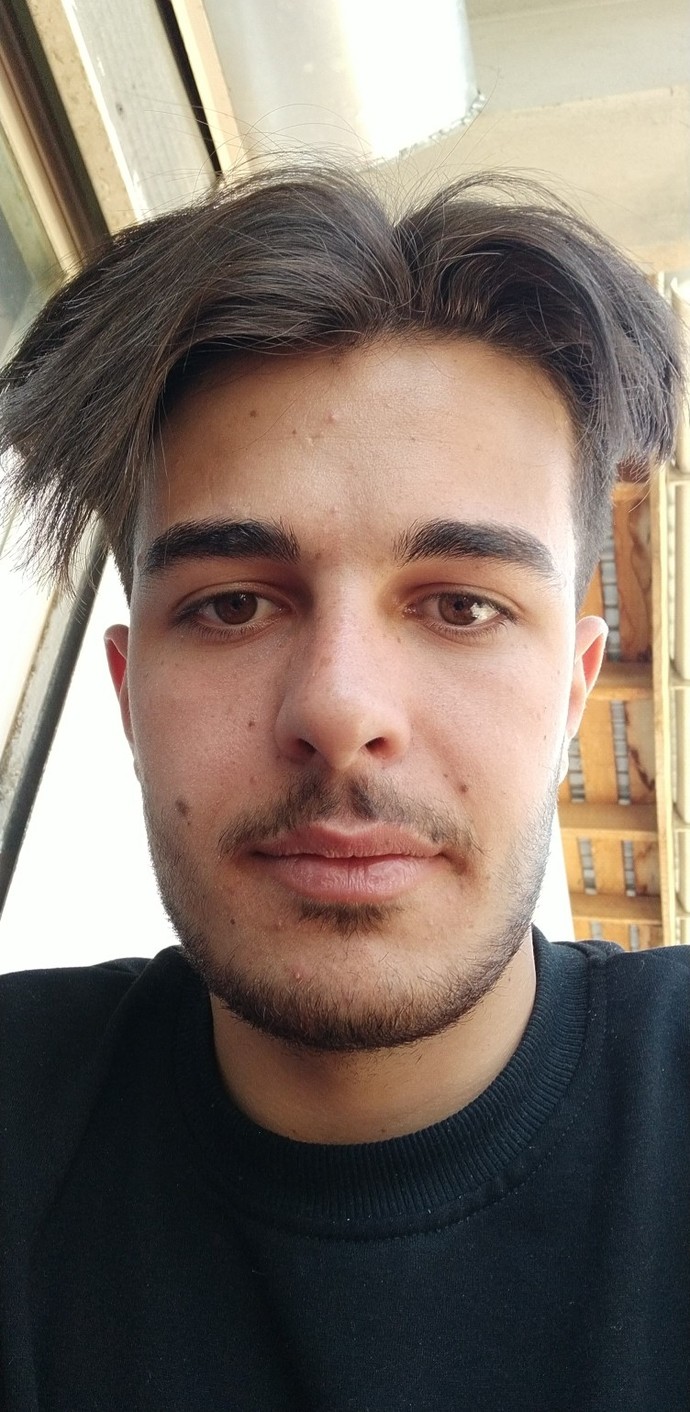 Yüzümdeki benleri aldırmalı mıyım?