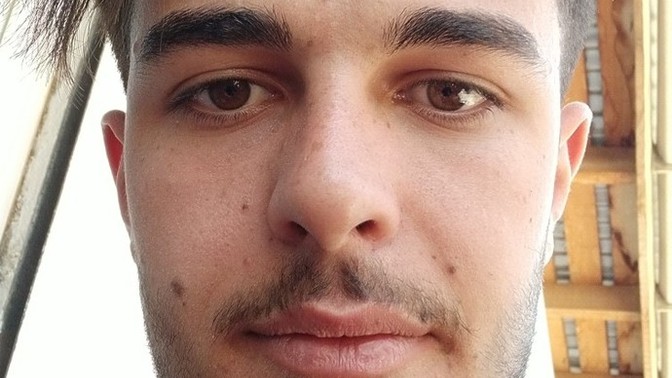 Yüzümdeki benleri aldırmalı mıyım?
