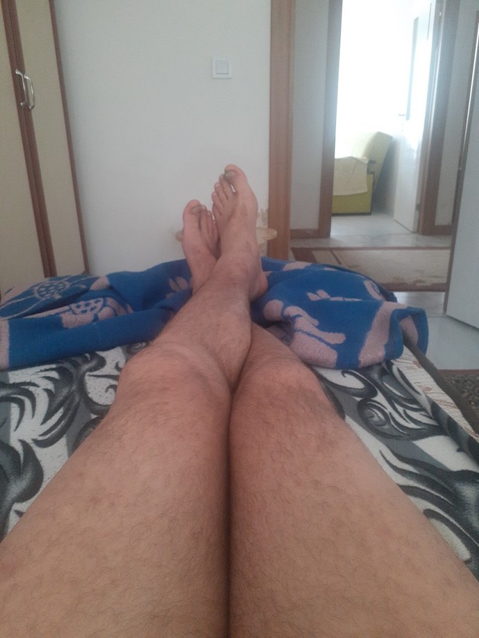 Bacaklarım cok çirkin napıcam?