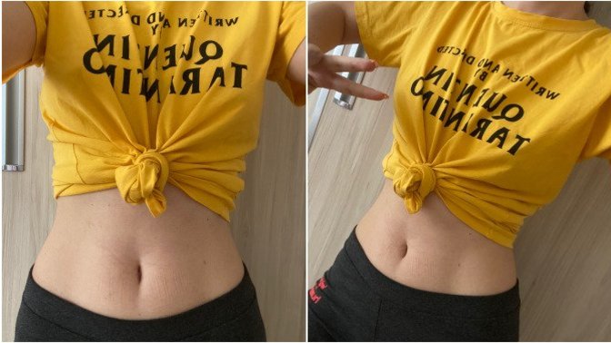 Tatilde bikini giyeceğim, sizce göbeğim yeterince ince mi?