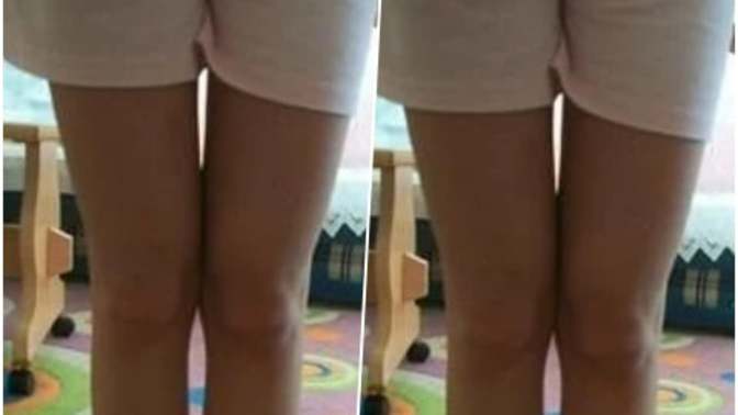 Bacaklarımın kalın olması için hangi sporu önerirsiniz?
