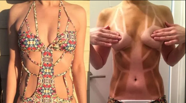 Tatilde bu bikiniyle güneşlenebilir miyim sizce?
