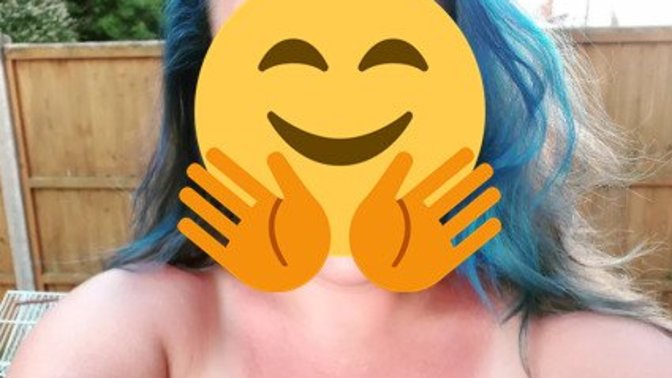Tatil bitti, bize yanıklar kaldı. Siz de yandınız mı?