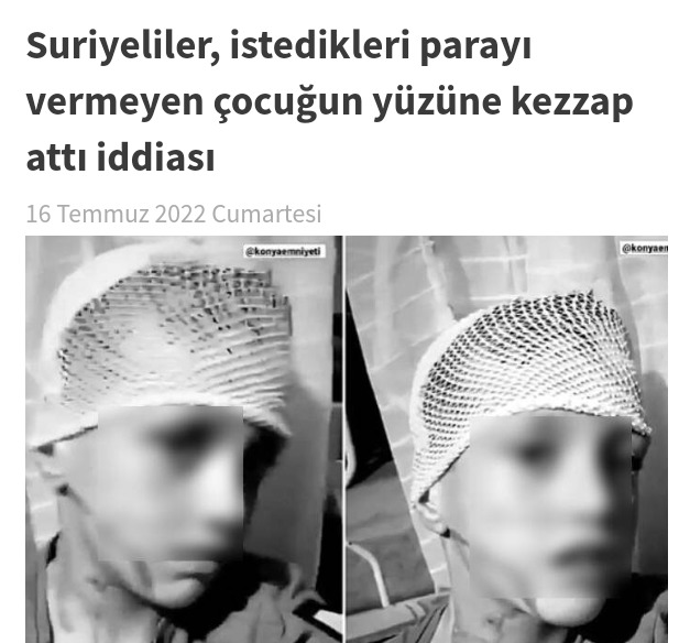 Suriyeliler, istedikleri parayı vermeyen çocuğun yüzüne kezzap attı iddiası. Bu nasıl bir vahşet?