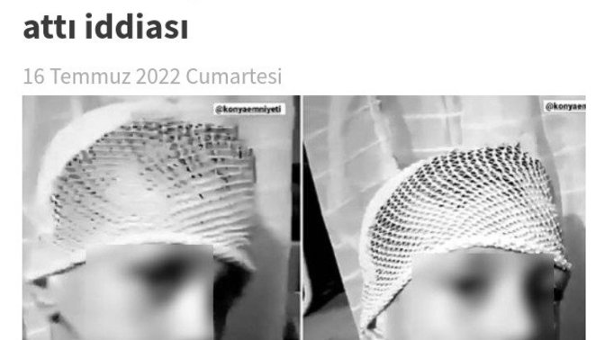 Suriyeliler, istedikleri parayı vermeyen çocuğun yüzüne kezzap attı iddiası. Bu nasıl bir vahşet?