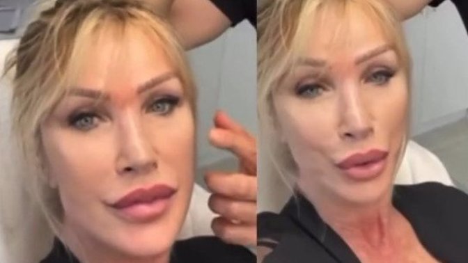 Seda Sayan yeni estetiği ile dikkat çekti. Yakıştırdınız mı yoksa abartı mı?