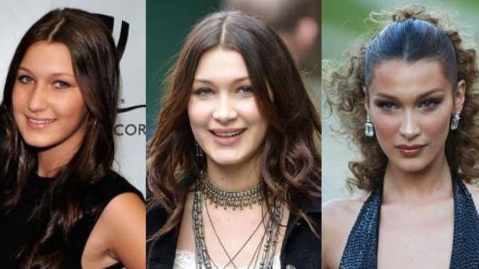 Bella Hadid'in yıllar içindeki değişimi! Estetiğe bir nimet diyebilir miyiz?