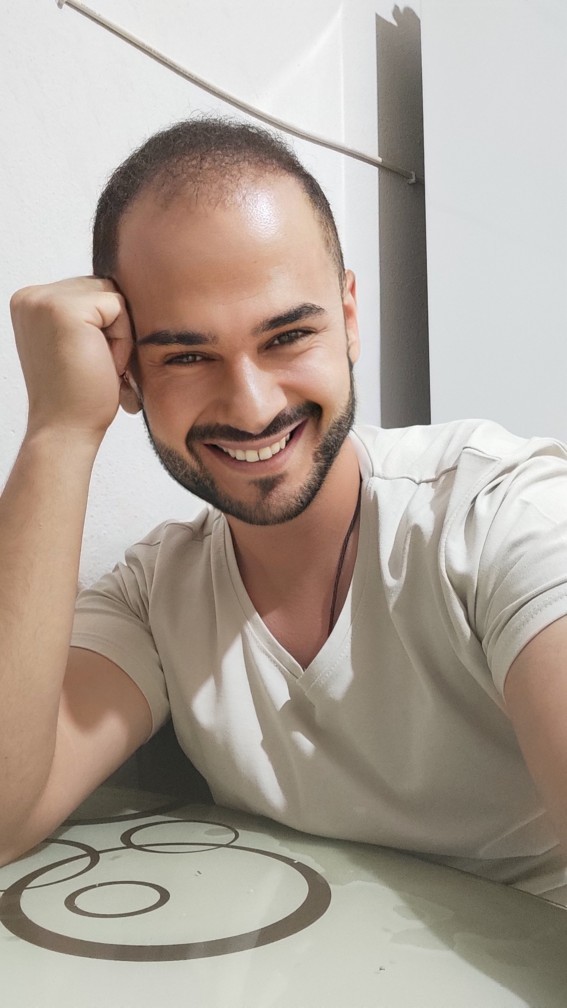 Aşırı bir şekilde dökülmeye başladı?
