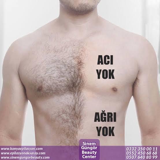 Erkek göğüs epilasyon hoş gözüküyor mu?