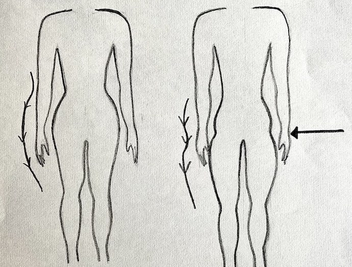 Hip Dips'lerimi düzeltmek için spora başladım, kaç aya düzelir sizce?
