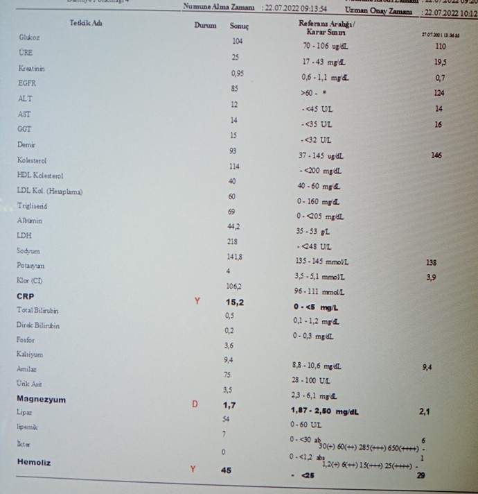 Sonuçlardan anlayan var mı?