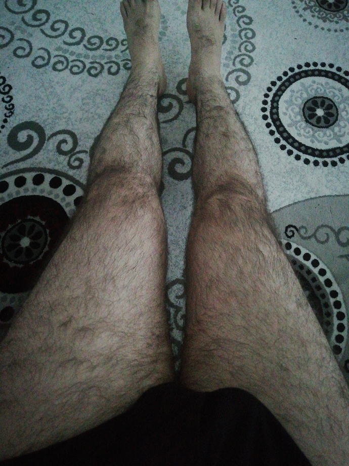 Ağda mı lazer mi