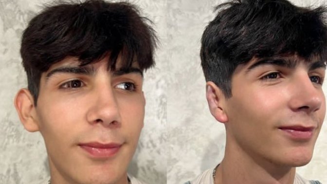 Taha Duymaz, bu sefer de kulak estetiği oldu. TikTok insanların güzellik algısıyla oynuyor mu?