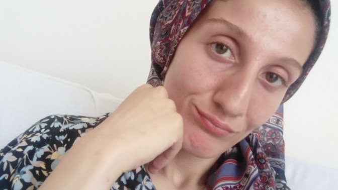 Ne kadar bakım yaparsam yapayım cildim düzelmiyor. Cildi pürüzsüz olanlar çok şanslı değil mi?