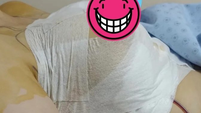 Meme büyütme operasyonu geçirdim. Küçük mü olmuş ya?