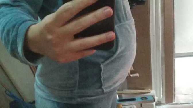 Regl olamadığınızda bu kadar şişkinlik yaşıyor musunuz, bu kadarı normal mi?