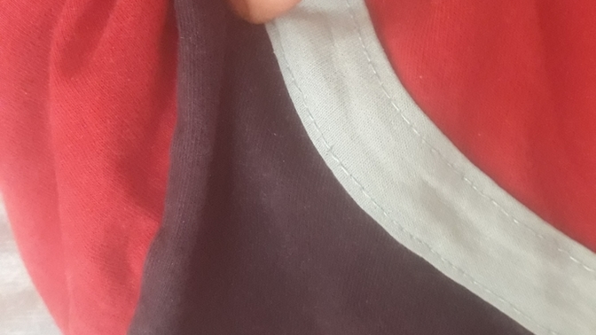 Arkadaşlar dokundugum yer sol omuzunun hemen altı ara sira ağrıyor burası neden kaynaklı acaba ?