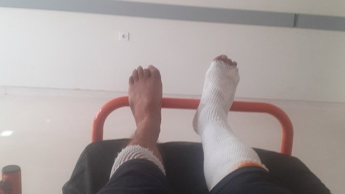 Açık yaraya yapışmış sargı bezi nasıl cikar?