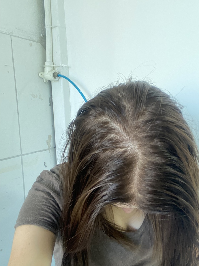 Saç diplerim çok açık hiç saçım kalmadı çok üzülüyorum?
