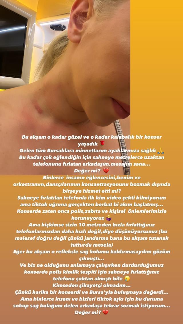 Ece Seçkine sahnede atılan telefon boynunu morarttı! TikTok akımı diye de bu kadarına gerek var mı?