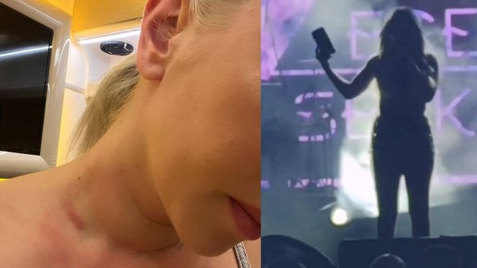 Ece Seçkin'e sahnede atılan telefon boynunu morarttı! TikTok akımı diye de bu kadarına gerek var mı?
