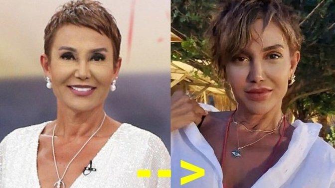 Ekranların tanınan yüzü Serap Paköz'ün estetiğini beğendiniz mi?
