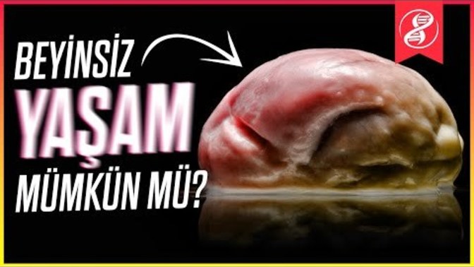 Beyninizin ne kadarı olmadan yaşayabilirsiniz?