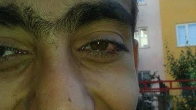 Arkadaşlar bu fotoğraf fake mi?