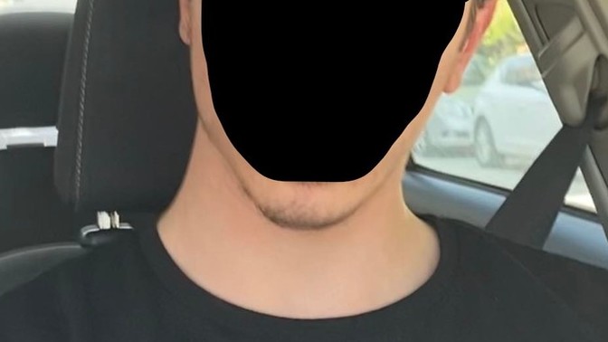 Çenem asimetrik, ne yapmalıyım?