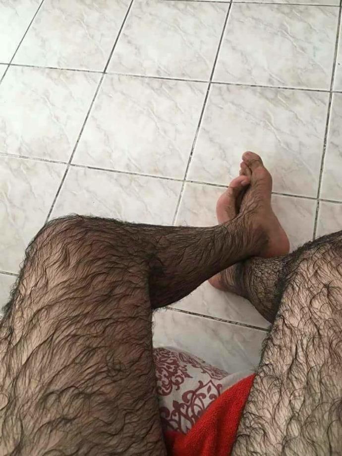Bacaklarımı almalı mıyım yoksa kalsın mı çok rahatsız ediyor?