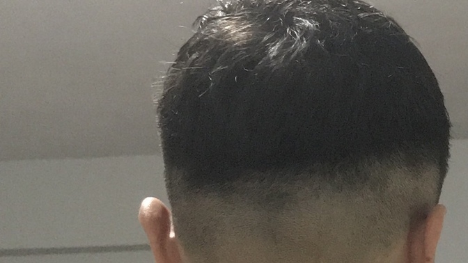 Saçımı kestim ensem normal mi?