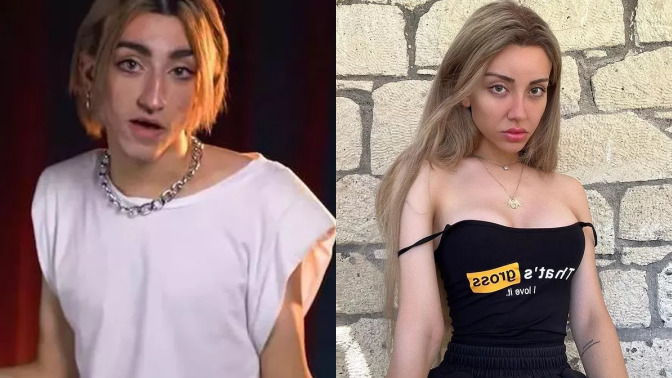 Tiktok Fenomenlerinin estetikli halleri çok ilginç 😵‍💫 En şaşırtıcı değişim hangisinde olmuş?