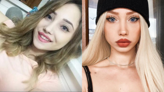 Tiktok Fenomenlerinin estetikli halleri çok ilginç 😵‍💫 En şaşırtıcı değişim hangisinde olmuş?