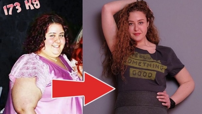 Oyuncu Aslı Samat tam 100 kilo verdi. Değişimini nasıl buldunuz?