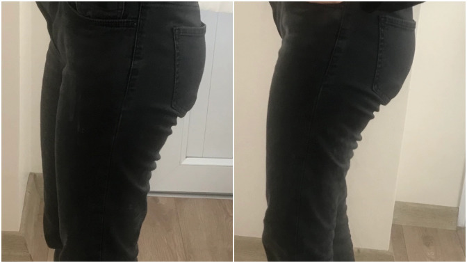 43 kiloyum ama zayıf olmama rağmen basenlerim ve kalçam var. Bu bölgeler nasıl erir?