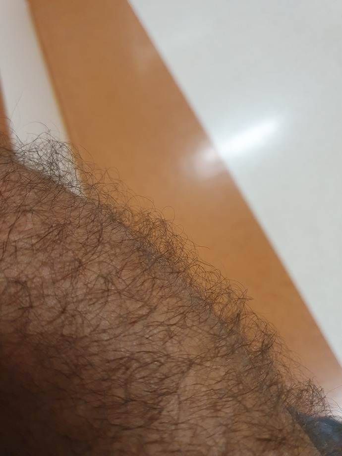 Kolumdaki kıllar düz değil kıvırcık bu nasıl düzeltirim çok çirkin duruyor?