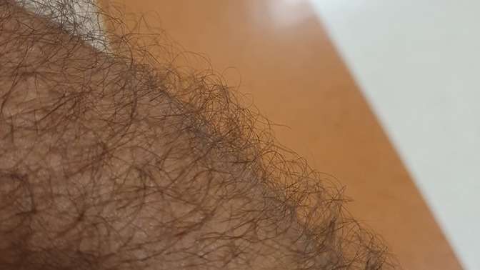Kolumdaki kıllar düz değil kıvırcık bu nasıl düzeltirim çok çirkin duruyor?