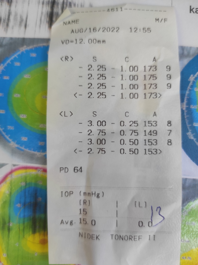 Göz mumaram kaç anlayan var mı arkadaşlar?